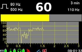 HL7000長時間監測